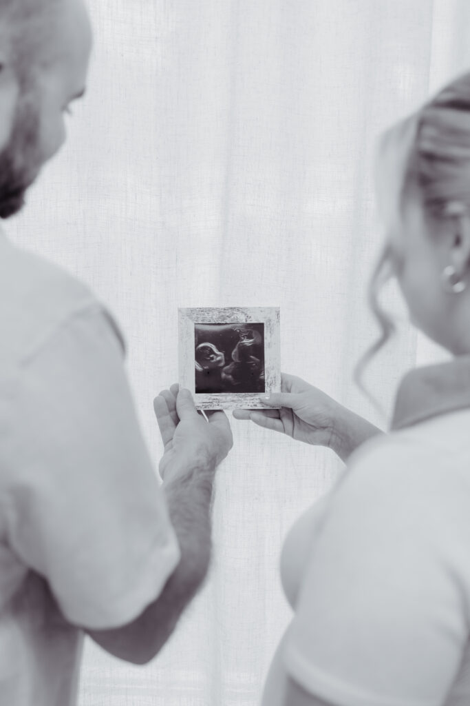 Black and white photo of a couple holding a framed photo of their baby's ultrasound